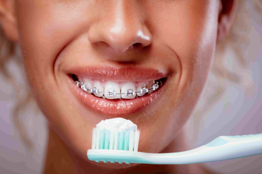 How to clean teeth with Braces