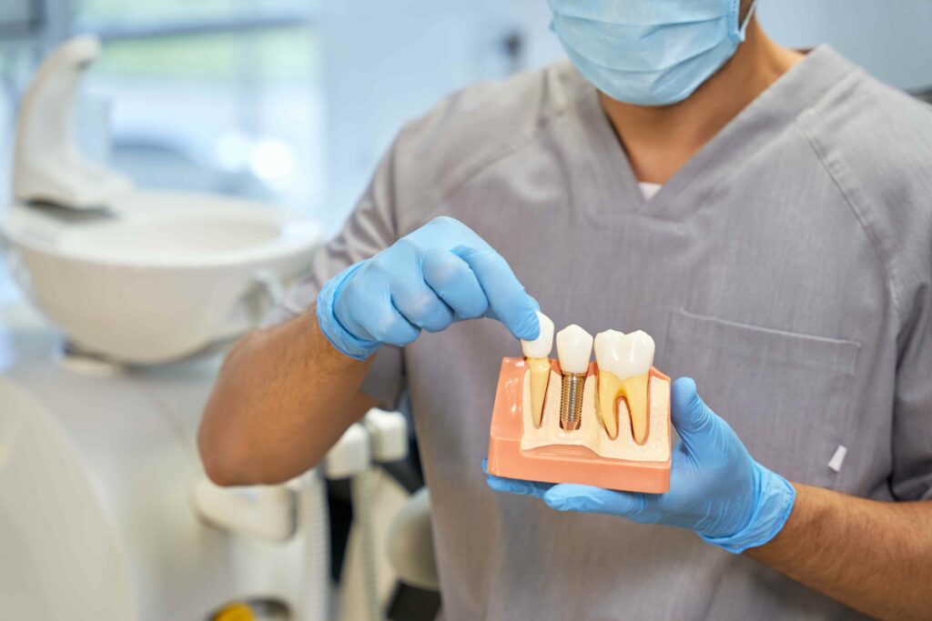 What is osseointegration of dental implants?