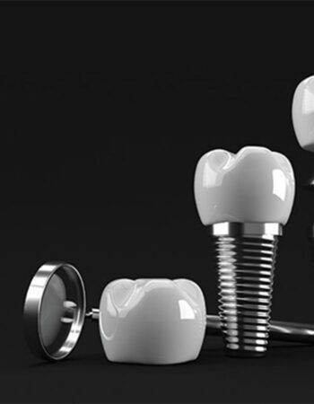 Ventajas y Desventajas de los Implantes Dentales Inmediatos