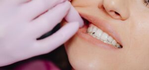 ¿Qué provoca la pérdida de los dientes?