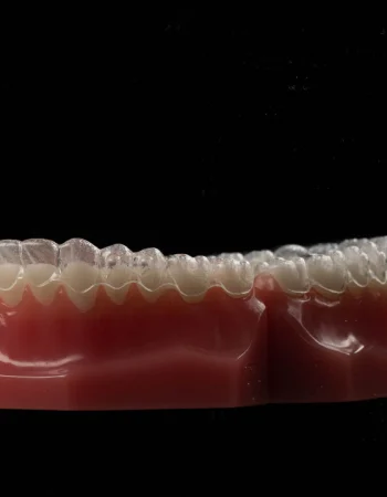 Ortodoncia invisible: ¿realmente funciona para todos los casos?