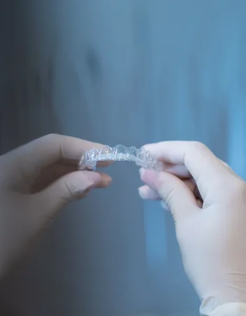 ¿Brackets o alineadores dentales para los niños? Consejos para padres y resultados a largo plazo