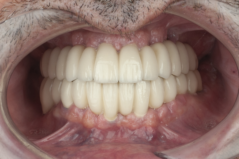 RPH_9860