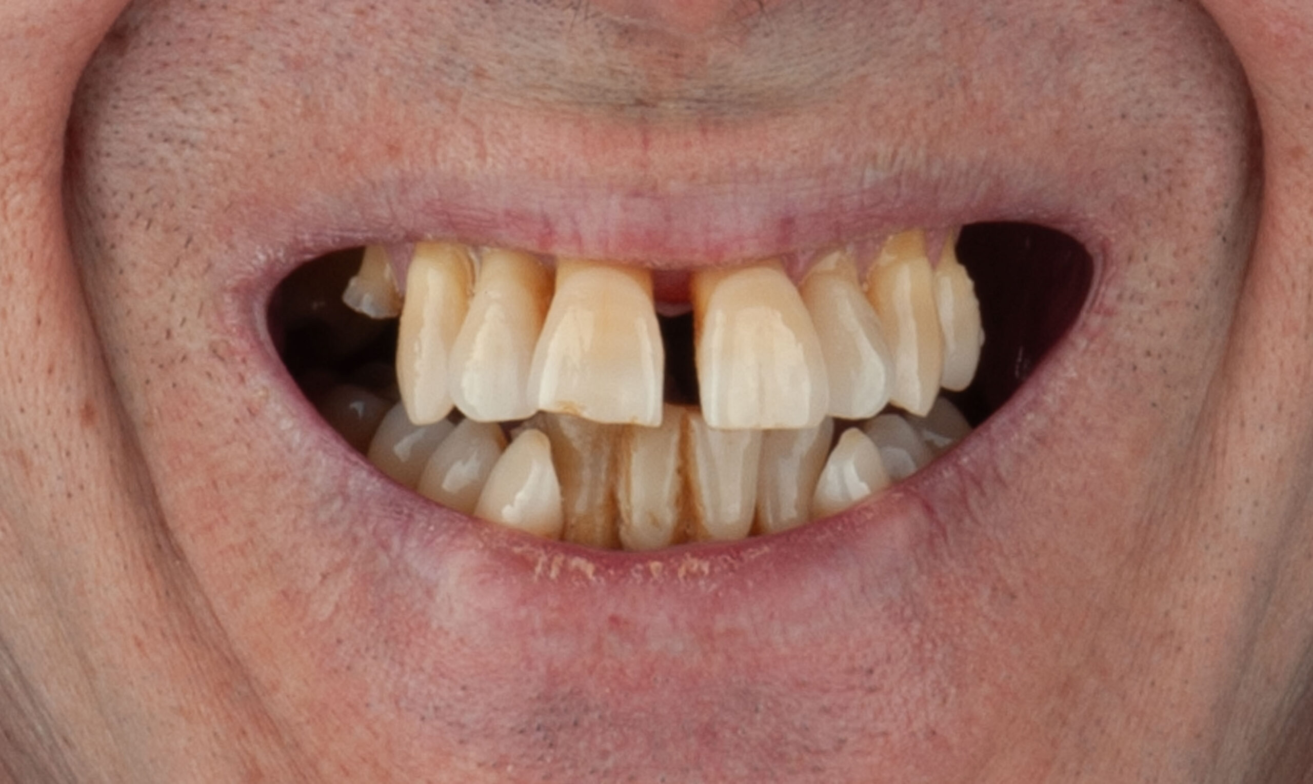 slider-antes-emilio-web