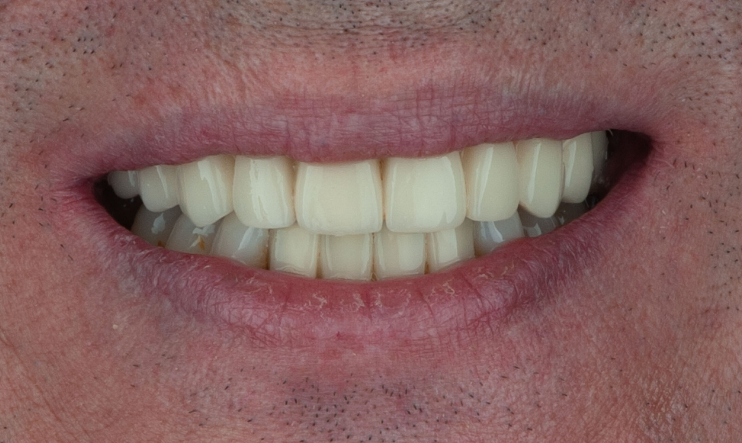 slider-desp-emilio-web