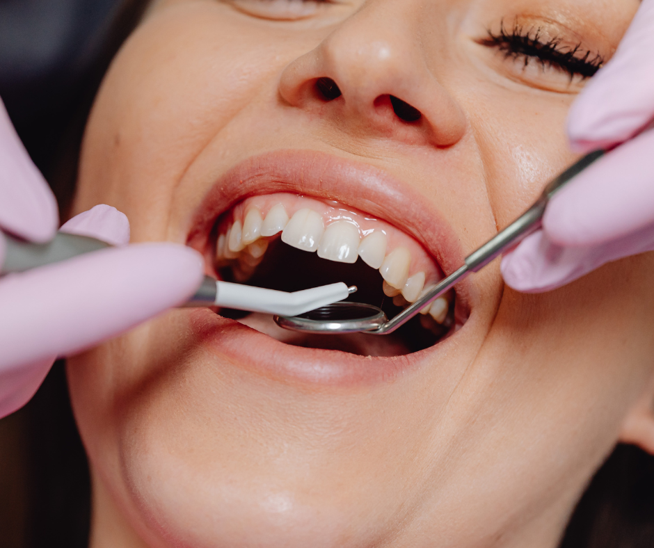 periodoncia-dental-corbella