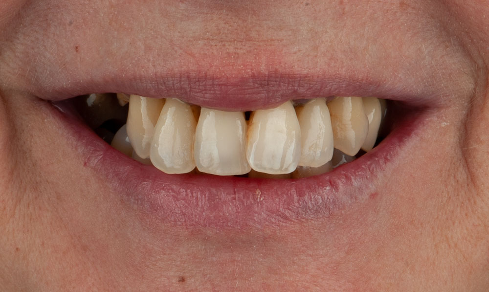 sonrisa-antes-margarita