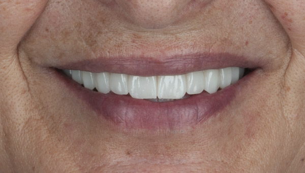 planificacioncaso-ana-bujan