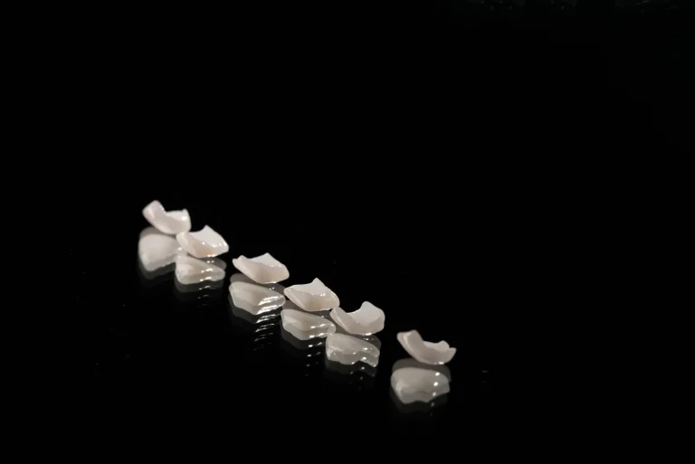 Carillas-dentalcorbella