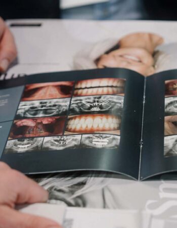 Dental Corbella en Gaceta Dental: Alliance Project